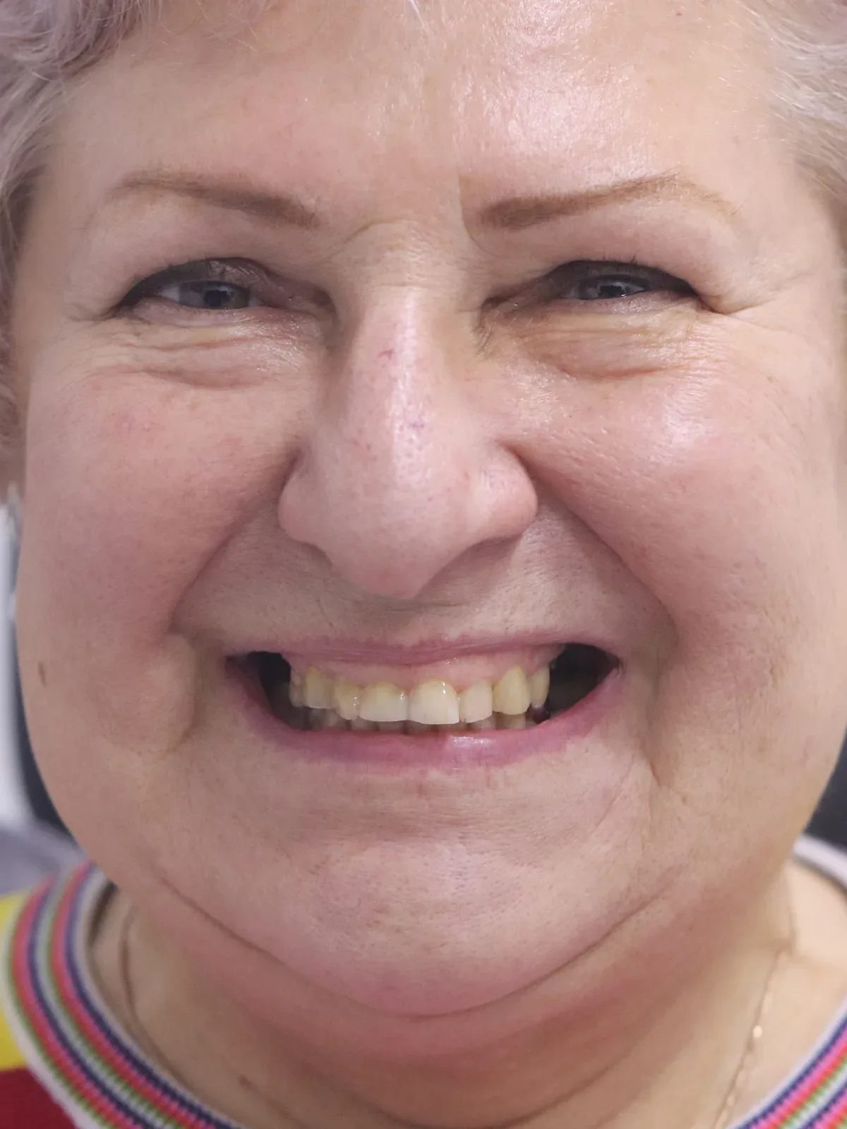 Before: Smile
