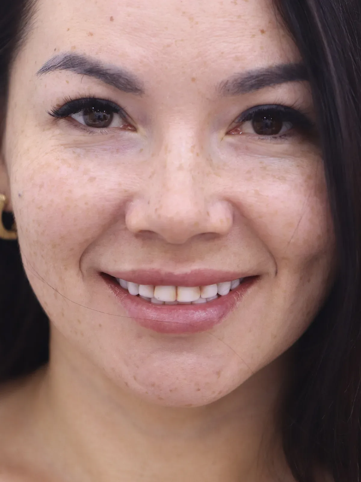 Before: Smile