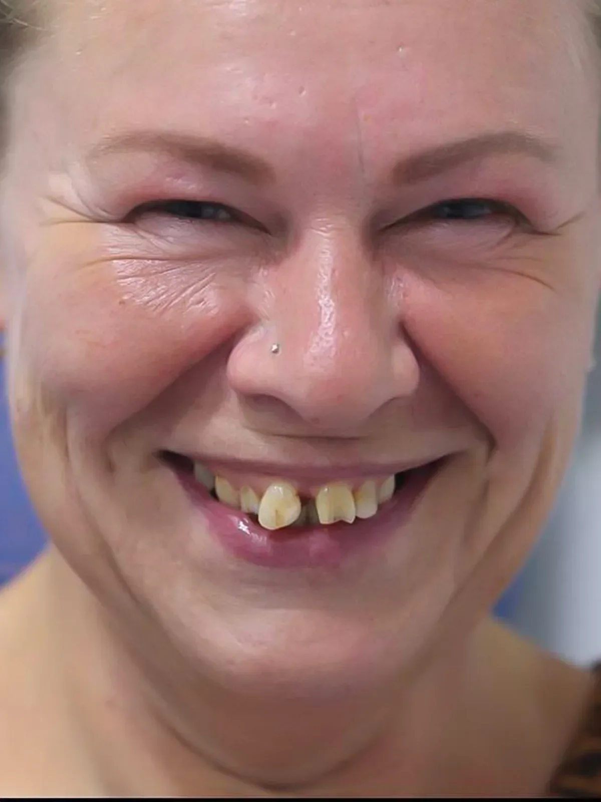 Before: Smile