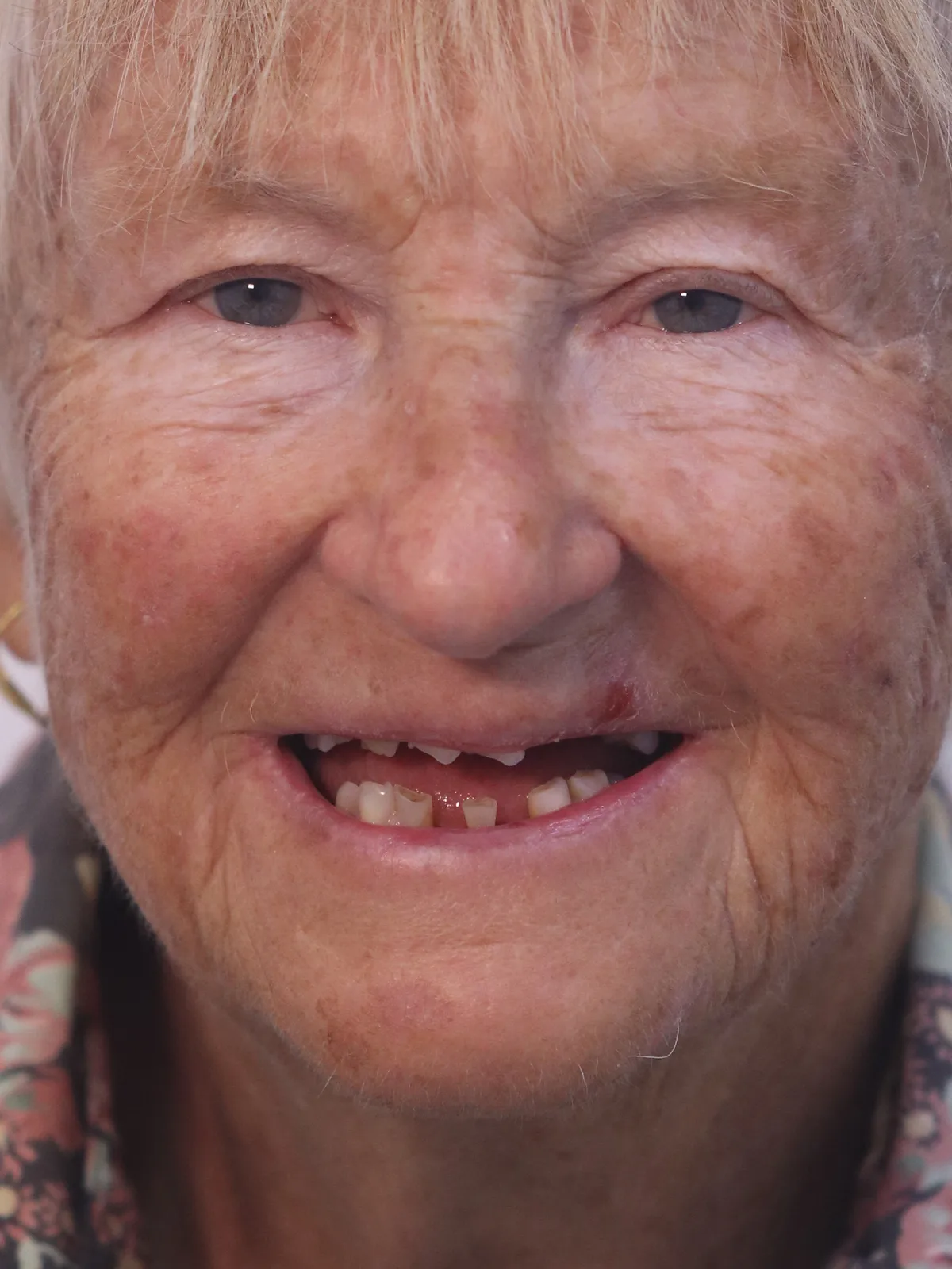 Before: Smile