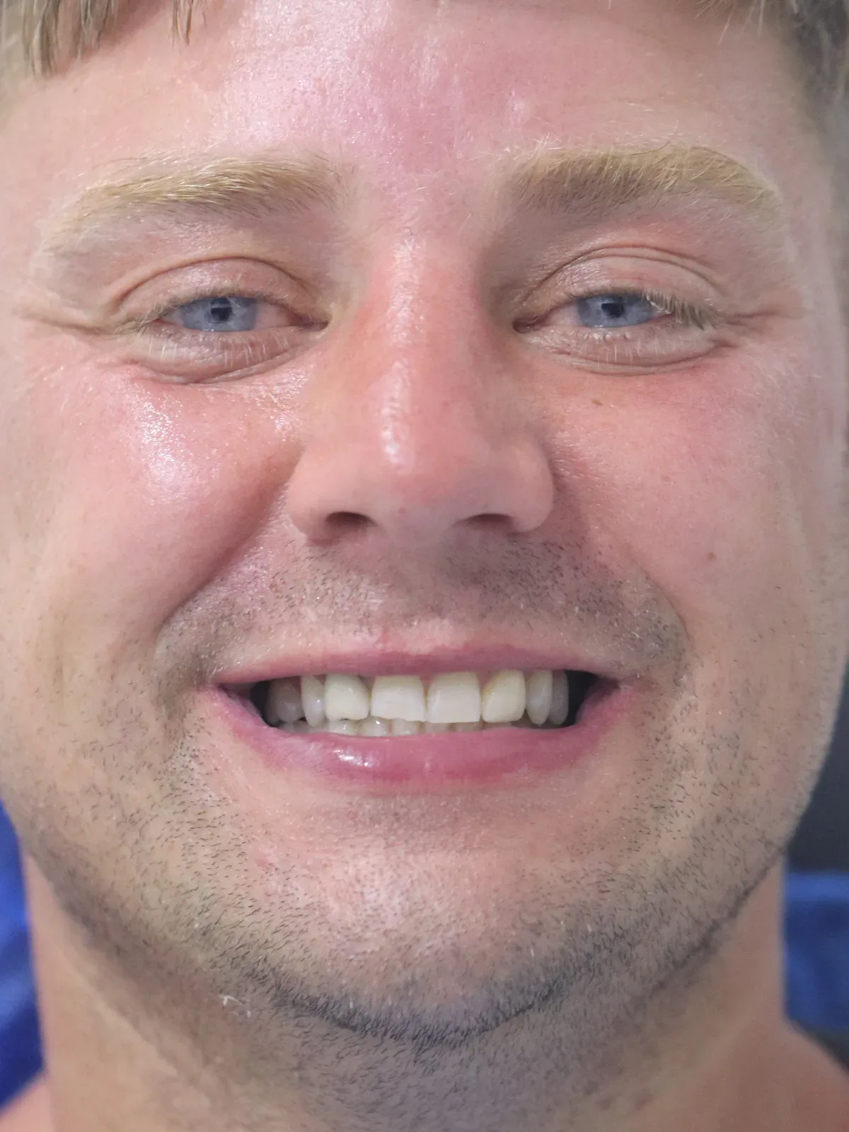 Before: Smile