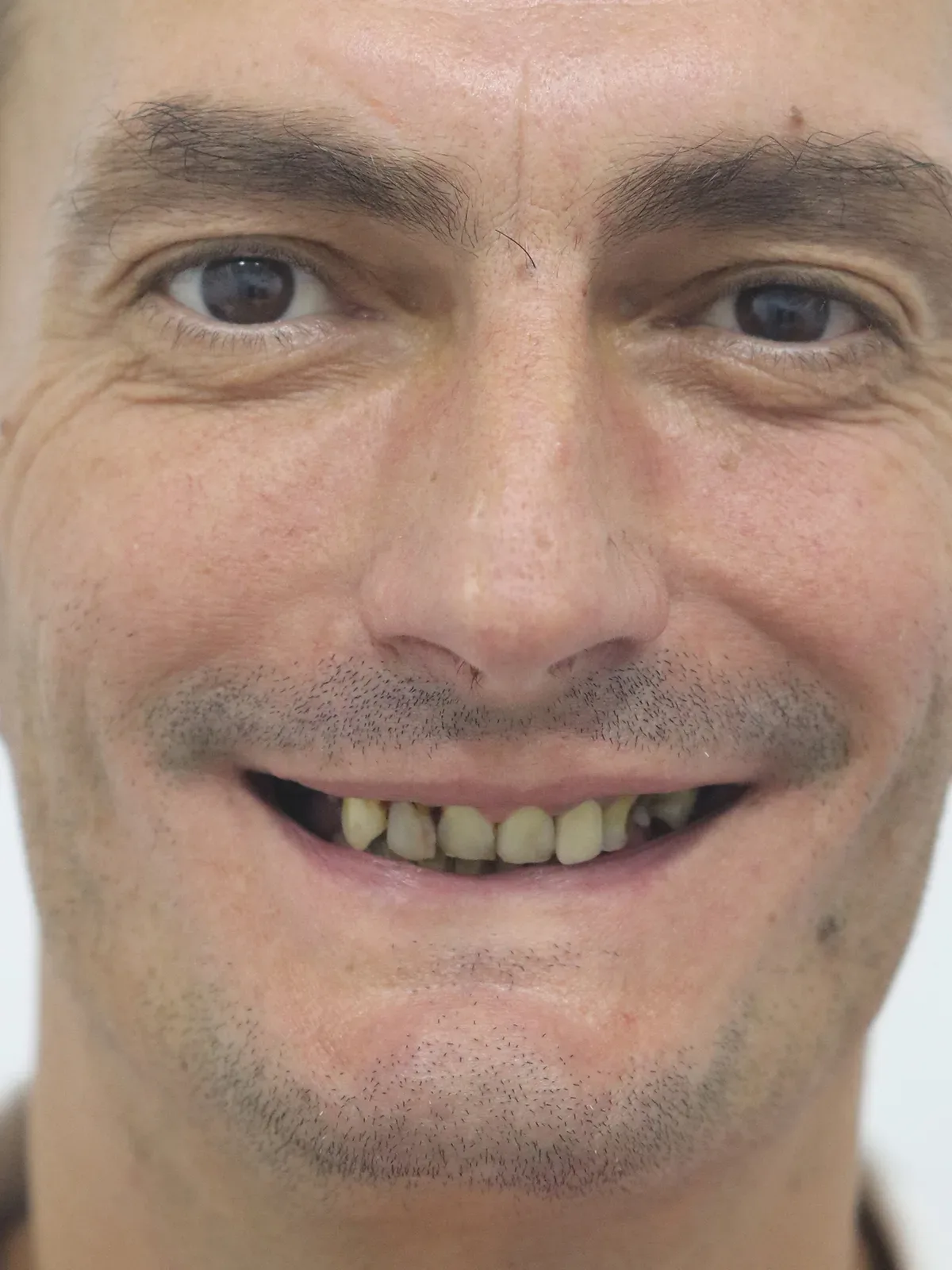 Before: Smile