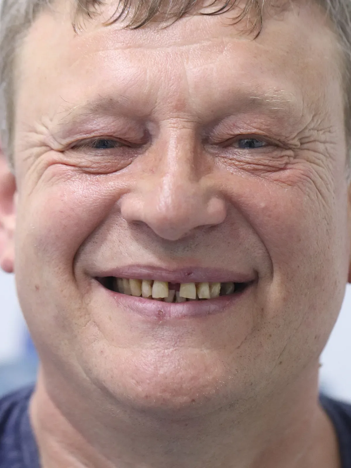 Before: Smile