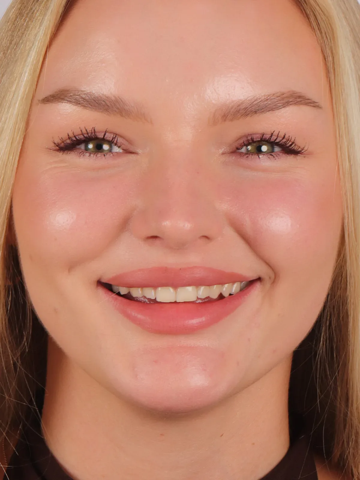 Before: Smile